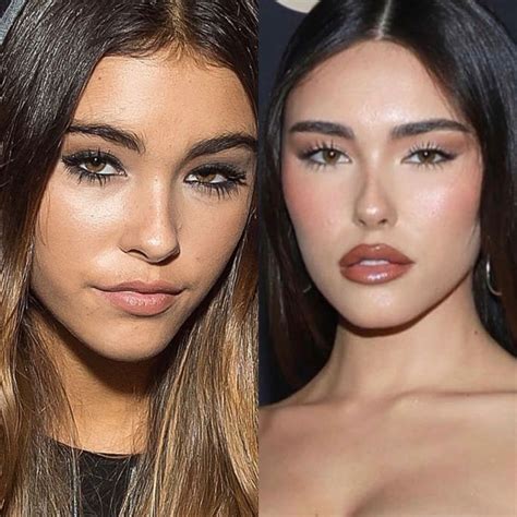 does madison beer have a boob job|Madison Beer plastic surgery: Breast Implants,Before。